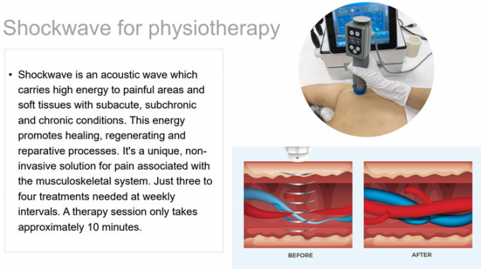 Equipamento da terapia da fisioterapia/onda de choque extracorporal/alívio das dores tecar da terapia terapia da inquietação